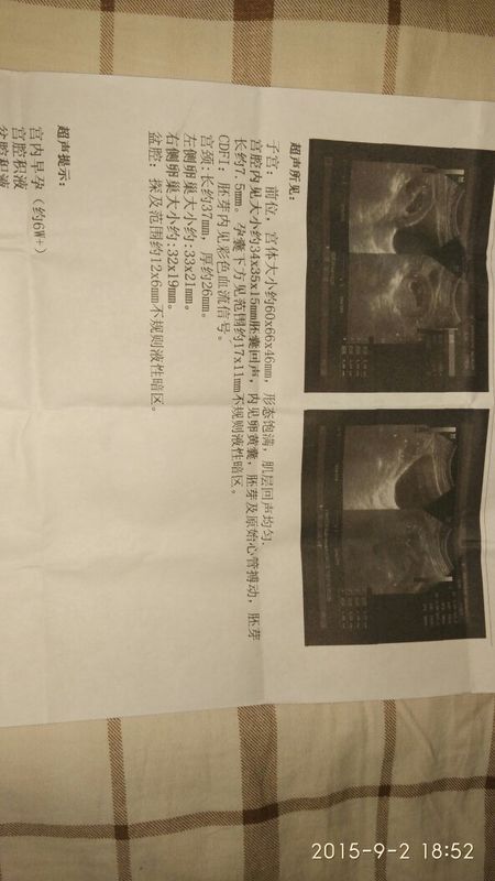 我媳妇刚刚能确定怀孕了,去医院做检查,本想看