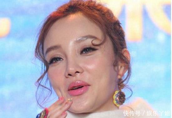 玻尿酸害人不浅,曹颖变网红脸,蔡明像蜡像,最后一位太吓人!