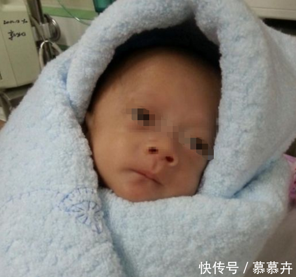 三个月婴儿被热水烫伤,孩子却不哭不闹,医生检