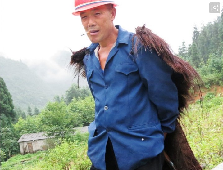 六岁男孩掉进沟里,爬起来手上沾满蛆,多年后发