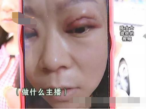 30多岁女子想去做主播 双眼皮手术后: 没信心了