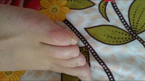 真正的汉族人是左脚小趾有俩层指甲 具体是怎