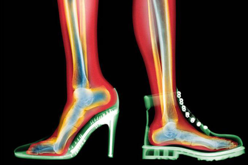 健康一问:为什么穿高跟鞋容易崴脚?