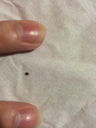 家里最近出现了很多这样的小虫子 暗红色 很小