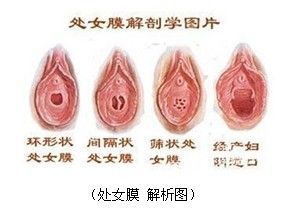 人造<em>处女膜</em>_360百科