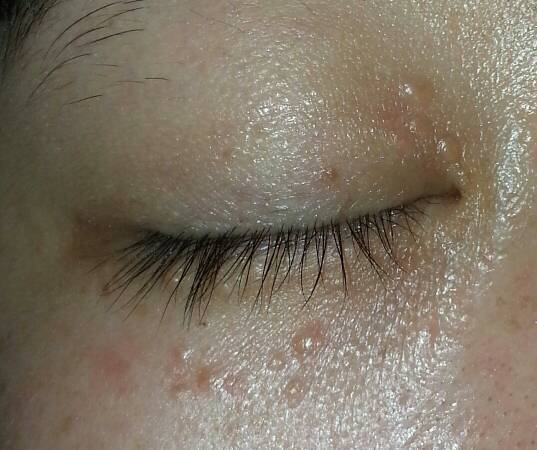 不知道眼睛周围长得是什么?且这几年好像越长