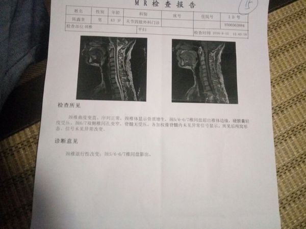 重庆华山中西药骨科医院,我手肩背部痛我去做