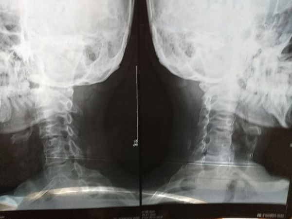 希望有医生朋友可以帮忙看一下 (患者是一位4