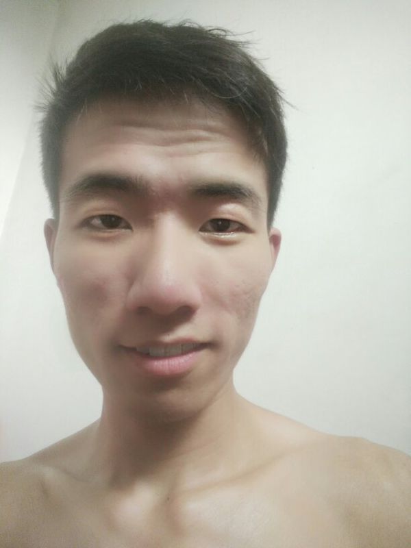 我发际线不齐适合留背头吗?大家在帮我看下我