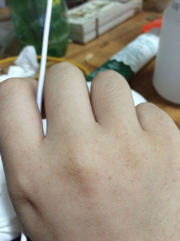 上起来,突然发现右手手背上长了好多小麻点,红