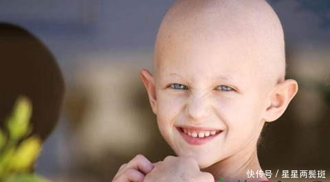 m3白血病治愈后能活多少年