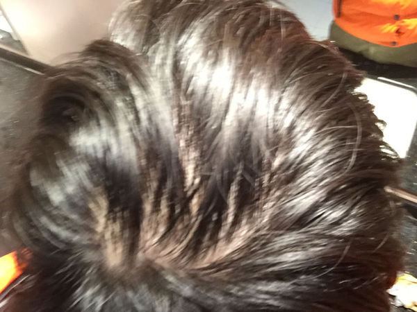 我高三每天洗头 一段时间染发次数多 这个是不
