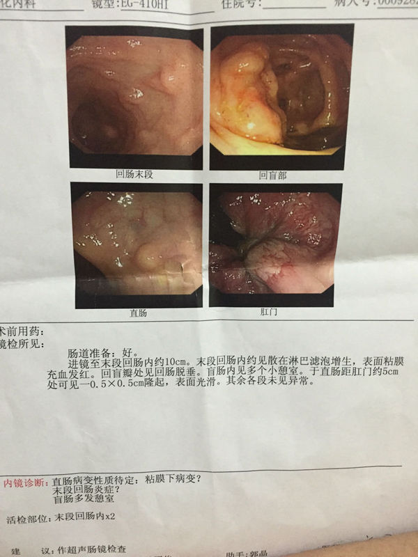 男朋友35岁,之前一直说小腹右侧偶尔疼痛,做了