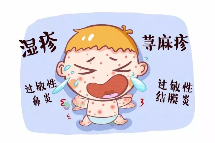孩子经常过敏应该怎么办?