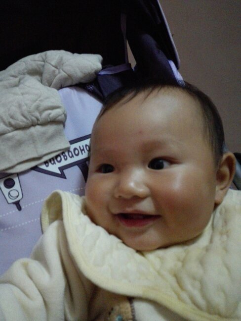 小朋友九个月大,脸上眼睛周围的皮肤有点发白