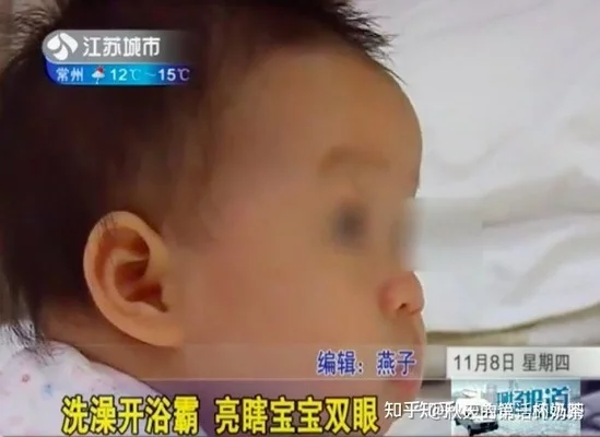 什么牌的浴霸质量好风暖(奥普浴霸热能环技术详解)