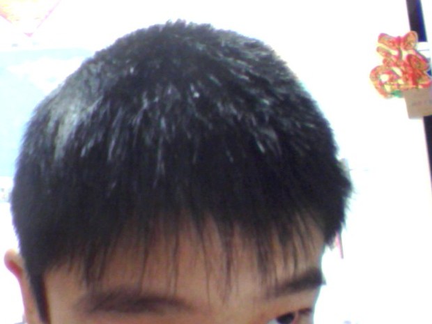 发<em>旋</em>_发<em>旋头发少</em>正常吗_发旋在右边刘海往哪