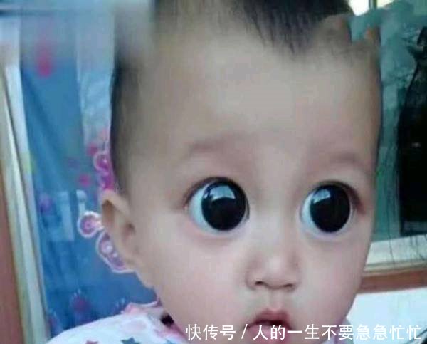 幼儿眼睛大的像牛眼睛,医院检查结果令家人哭