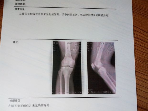 骨骼闭合片子 关于长个_360问答