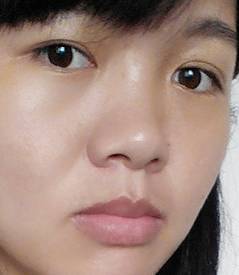 嘴唇太厚怎么办_360问答