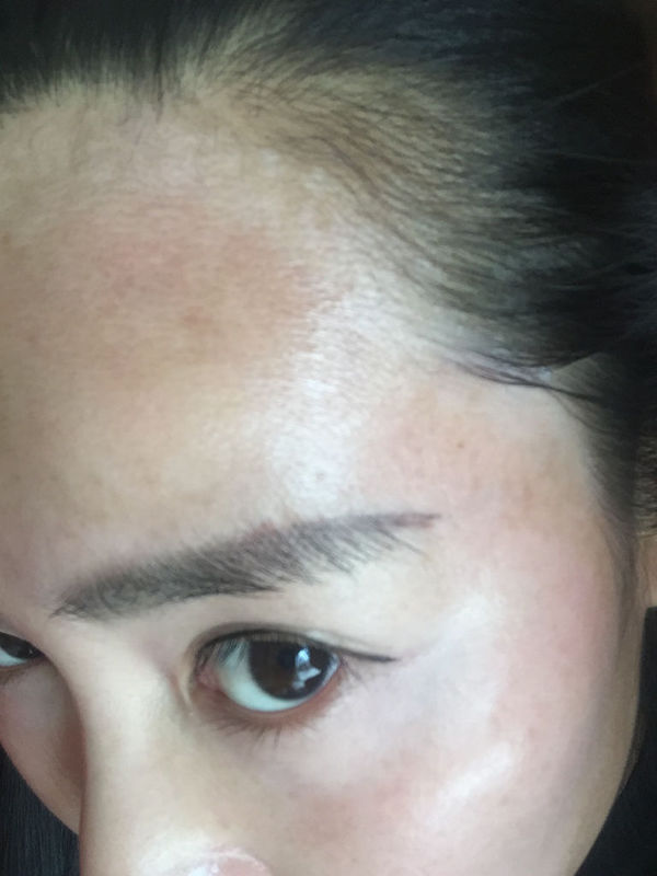 我今年三十岁,去年春天额头发跟处长了一块白