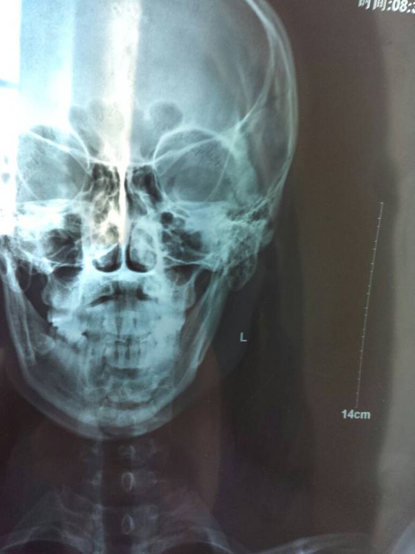 请问,这个片子L代表的是我的左脸(左手边的脸