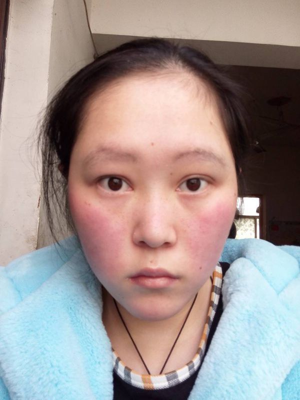 我的人中长吗?_360问答