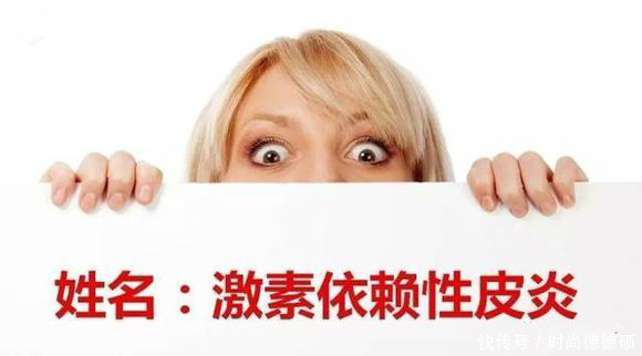 激素脸怎么才能治得好,激素脸怎么治疗才能好得快