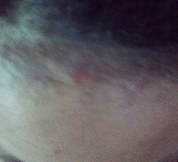 头上有些难看的逗逗,不知道是什么,特别难看,有