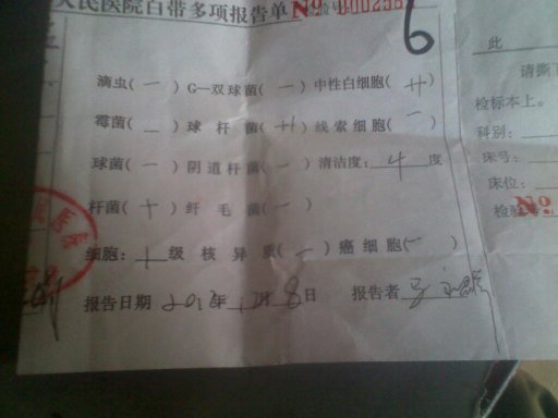 下面是我的白带化验单,求专业人士帮我看看这