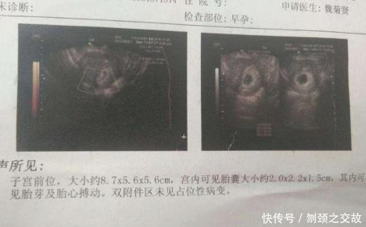 怀孕后什么时候做B超 t01f16711d4189caa97.jpg