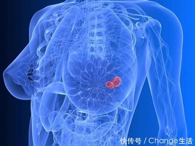 4种癌症都是吃出来的,医生:我从不吃这些\"毒物\"