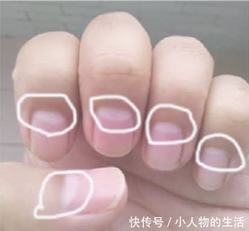 手指的月牙白代表什么?知道这些替你省了上医