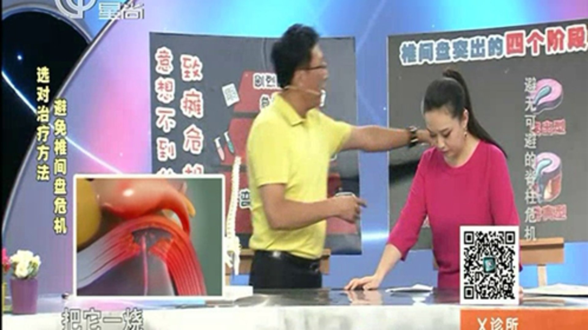 X诊所. 避无可避的脊柱危机
