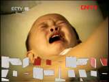 健康之路 《健康之路》 20110830 不退的高烧