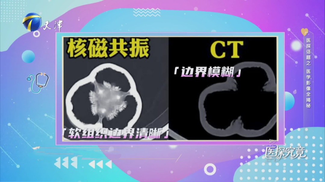 医学影像全揭秘