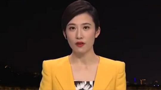 1818黄金眼 术后恢复已两年 还是觉得币子歪