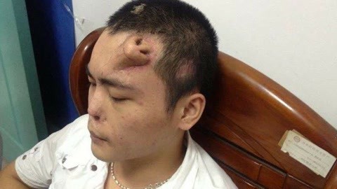 算命先生便利店 新生婴儿有两个鼻子，秘鲁妈妈产下怪胎将做整形手术
