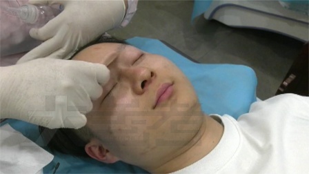 脸上长痘痘不要怕，中医支招：饮食规律，不要熬夜，可以喝绿茶