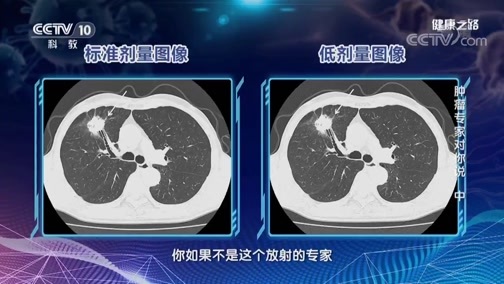 健康之路 《健康之路》 20190518 肿瘤专家对你说（中）