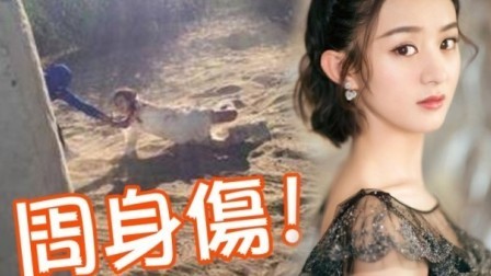 土豆娱乐快报 2018 2月 伤病缠身 赵丽颖伤腰体重不足八十斤