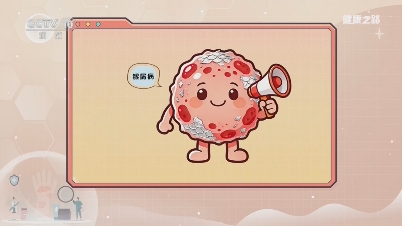 健康之路 《健康之路》 20260331 别让皮肤病纠缠你 1