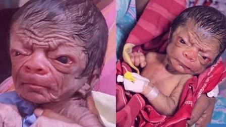 聊斋怪谈 男婴患早衰症 刚出生就如同80岁 3天后死亡！