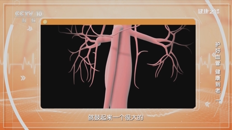 健康之路 《健康之路》 20230614 护好血管 健康到老（一）