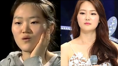 第8期：自卑少女整容改造100天获新生
