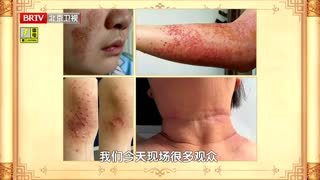 养生堂_20260719_暑湿“烤”验 科学应战 小心你身上的“湿气地图”