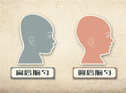 视知百科 圆后脑勺比扁脑袋聪明吗？