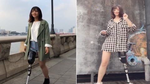 涨健识 最美假肢女孩穿短裙热舞