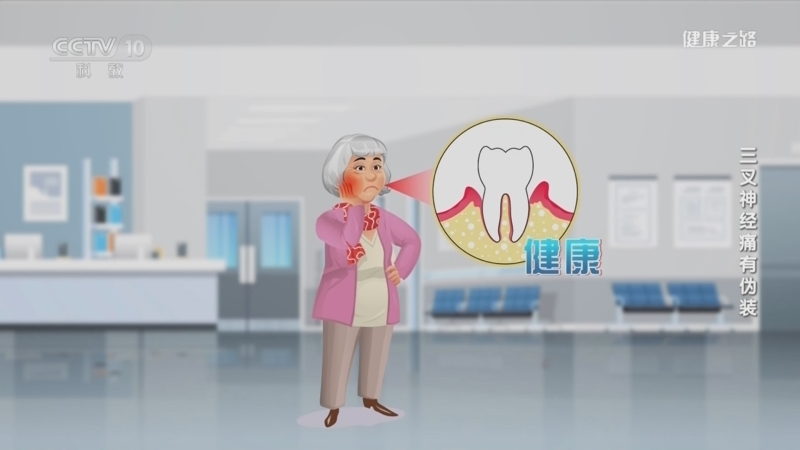 健康之路 《健康之路》 20230728 三叉神经痛有伪装