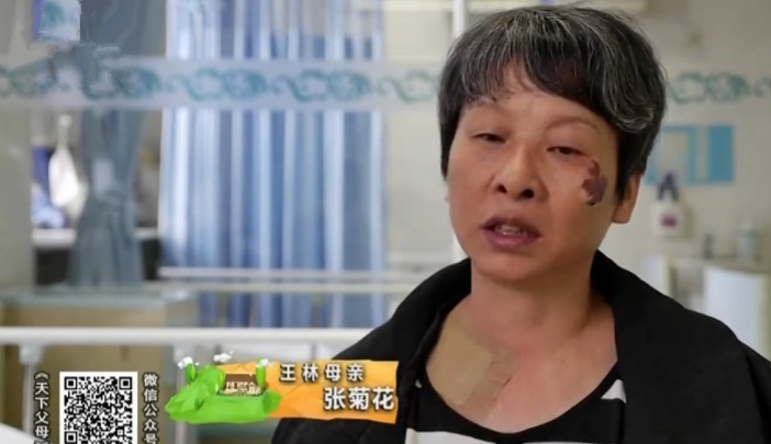 天下父母 六旬母亲割肾救子